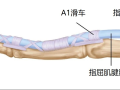隨州市中心醫(yī)院【特色技術(shù)】超聲引導(dǎo)小針刀松解術(shù) 告別“扳機(jī)指”困擾